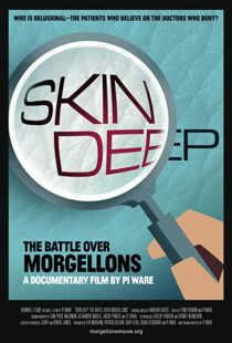دانلود مستند Skin Deep: The Battle Over Morgellons 2019104233-1699069671